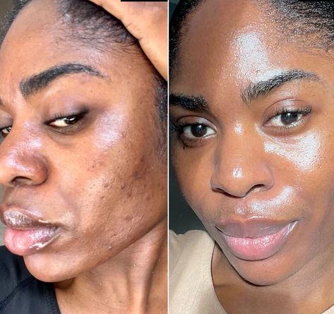 Beurre De Karité, Hydratant Naturel Pour le Corps